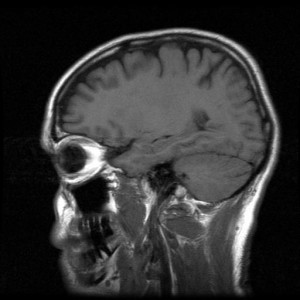 photo of a brain scan